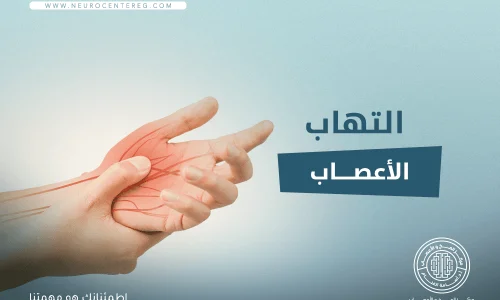 اسباب التهاب الاعصاب