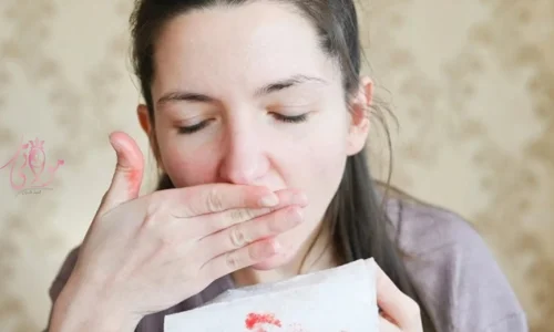 تعرف على تفسير رؤية الدم من الفم في المنام لابن سيرين