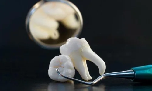 ما تفسير رؤية خلع الضرس في المنام لابن سيرين؟