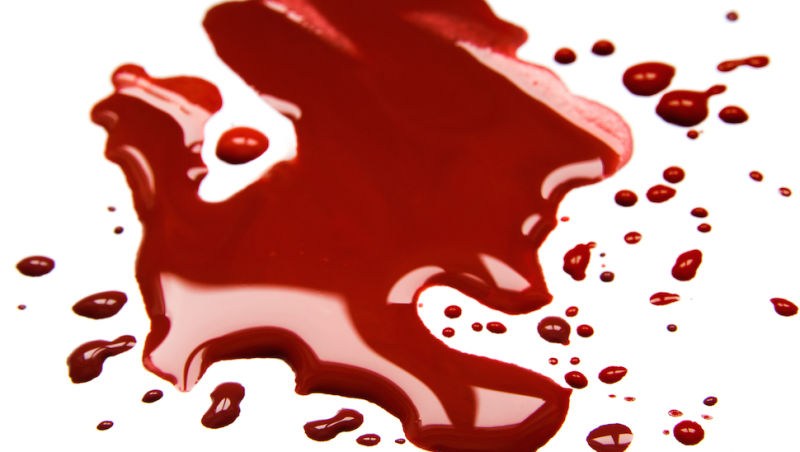 ما هو تفسير حلم الدم لابن سيرين وكبار المفسرين؟