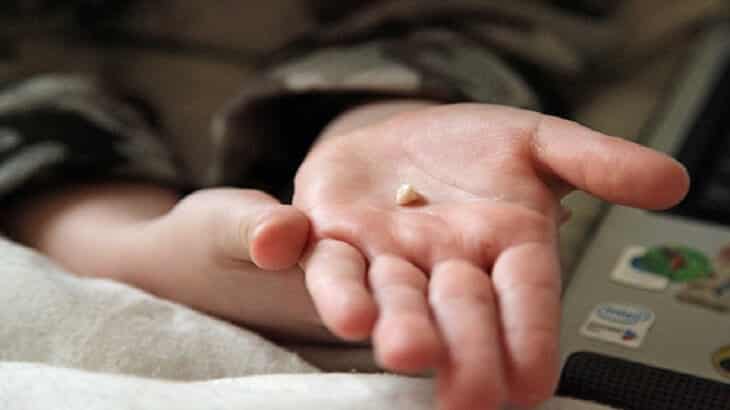 تفسير حلم سقوط الأسنان في اليد