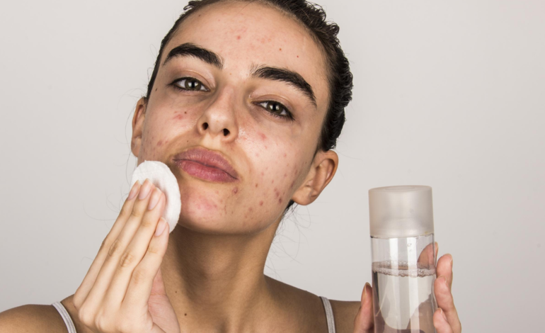 أفضل غسول للبشرة الدهنية وحب الشباب بالأسعار