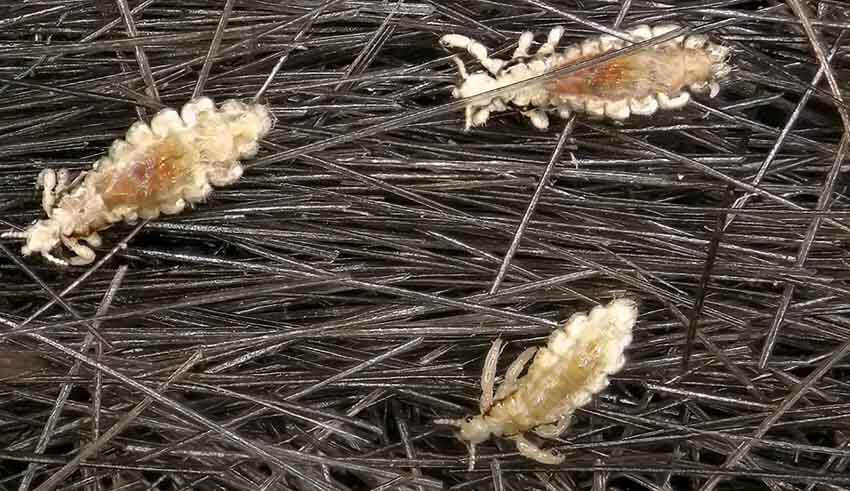 أهم 20 تفسير لرؤية القمل في المنام للمتزوجه