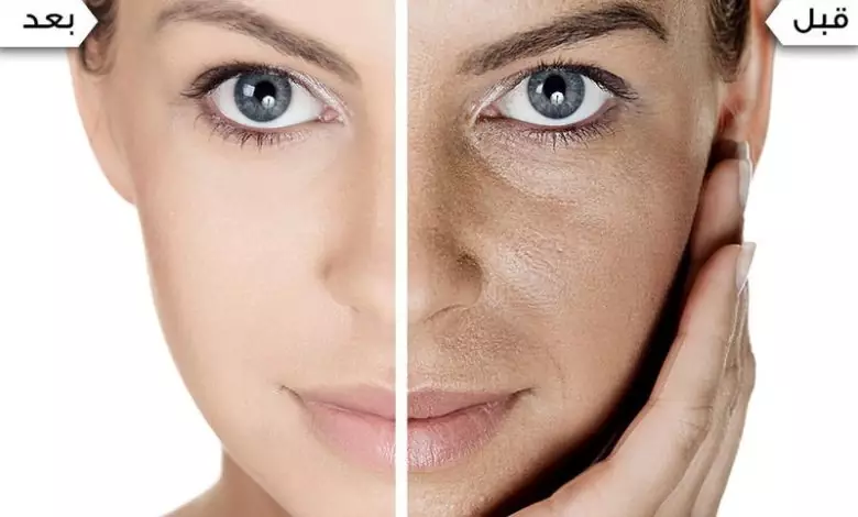 كريم مبيض للوجه من الصيدلية وأسعاره