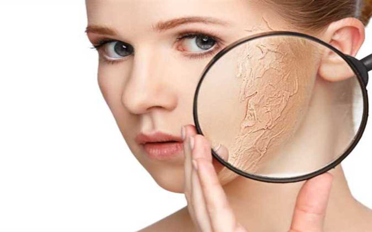 البشرة الجافة وما هي مضاعفات عدم الاعتناء بالبشرة الجافة؟