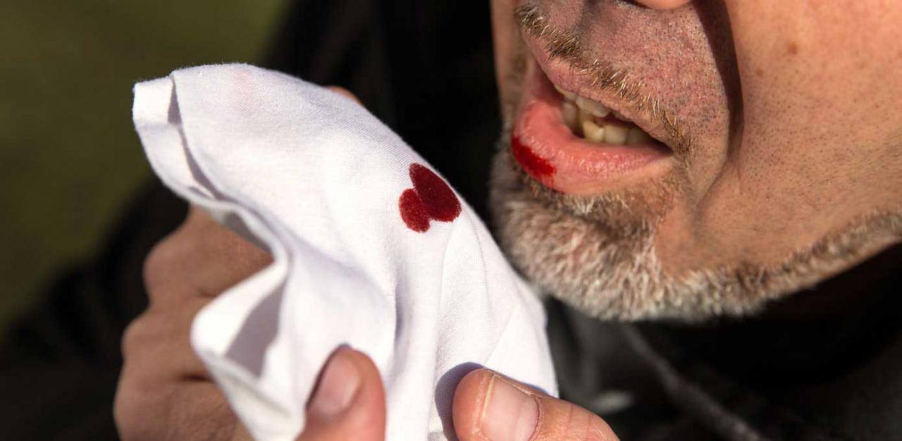 رؤية الدم في المنام يخرج من شخص آخر للمتزوجة لابن سيرين