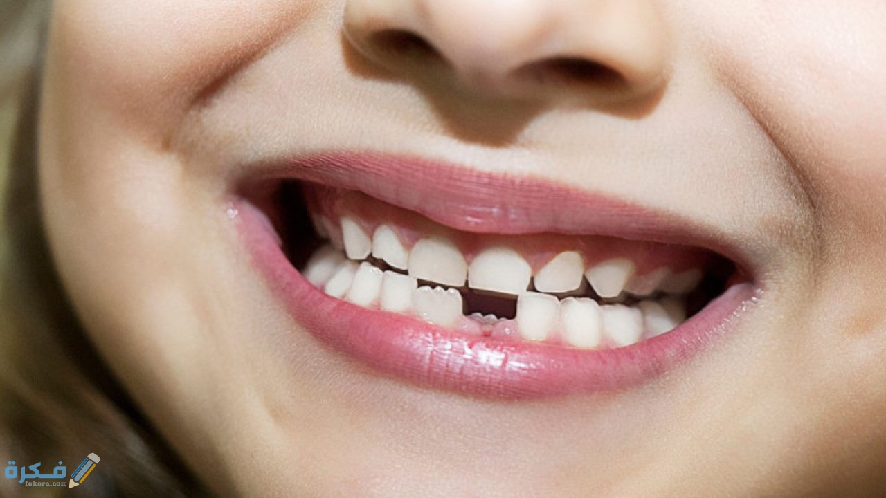 تفسير حلم سقوط الأسنان السفلية