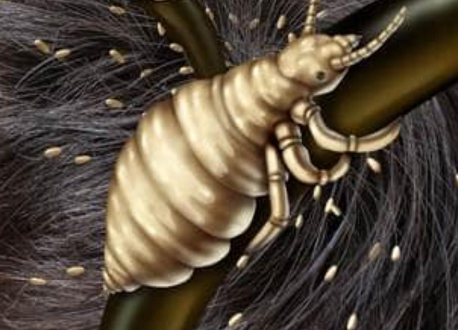 تفسير حلم القمل في الشعر وقتله للمتزوجة لابن سيرين