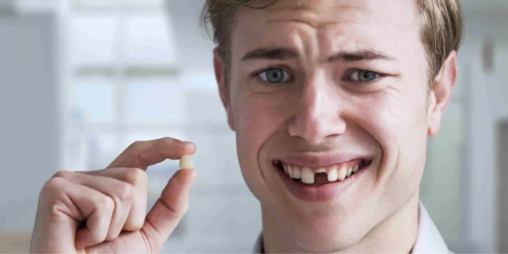 حلمت اسناني الاماميه طاحت