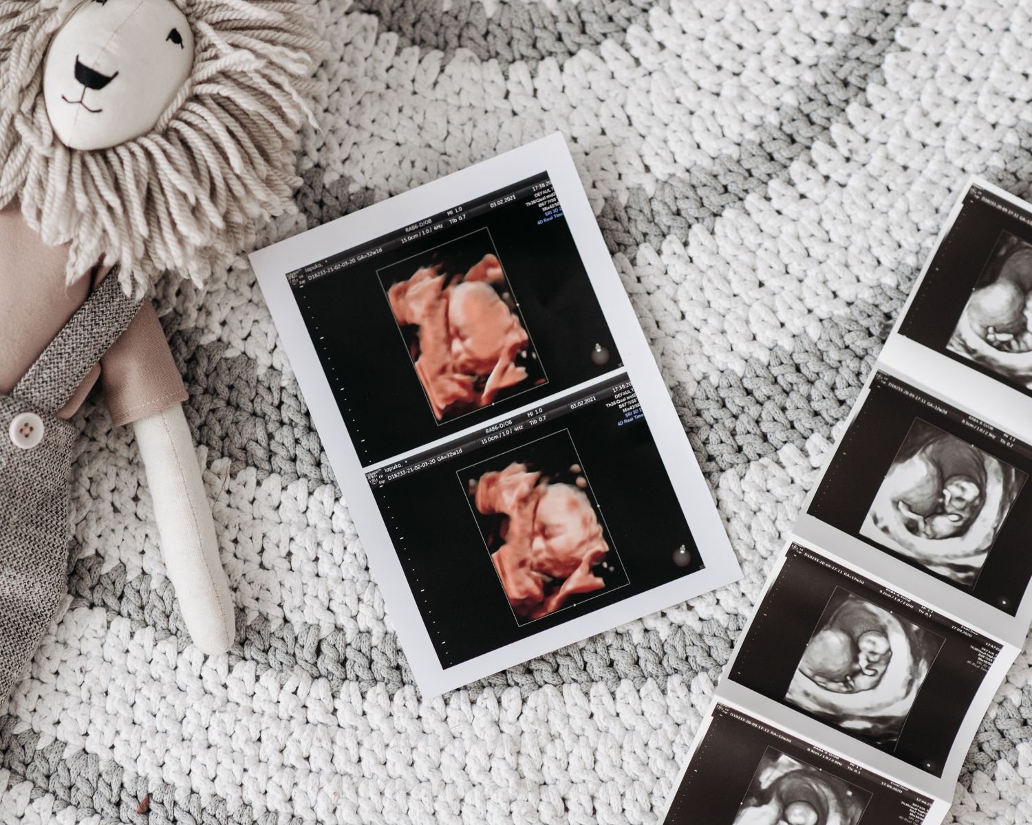 تعرف على تفسير رؤيا الحمل بولد