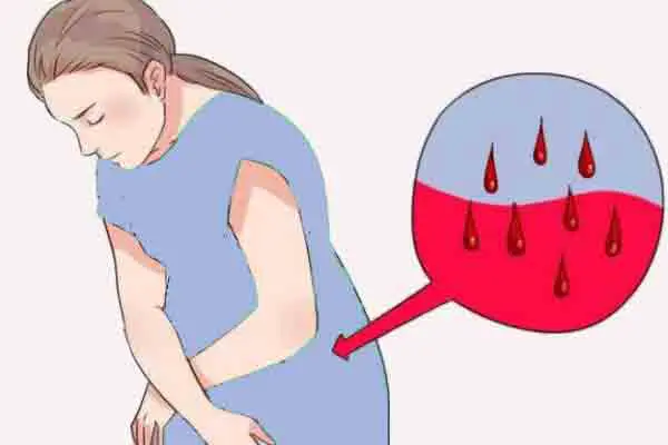 اعرف تفسير حلم نزول دم للحامل في الشهر الثالث في المنام لابن سيرين