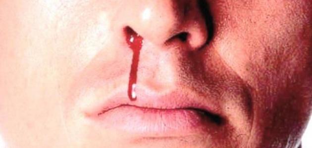 حلمت ان خشمي ينزف دم بغزارة لابن سيرين