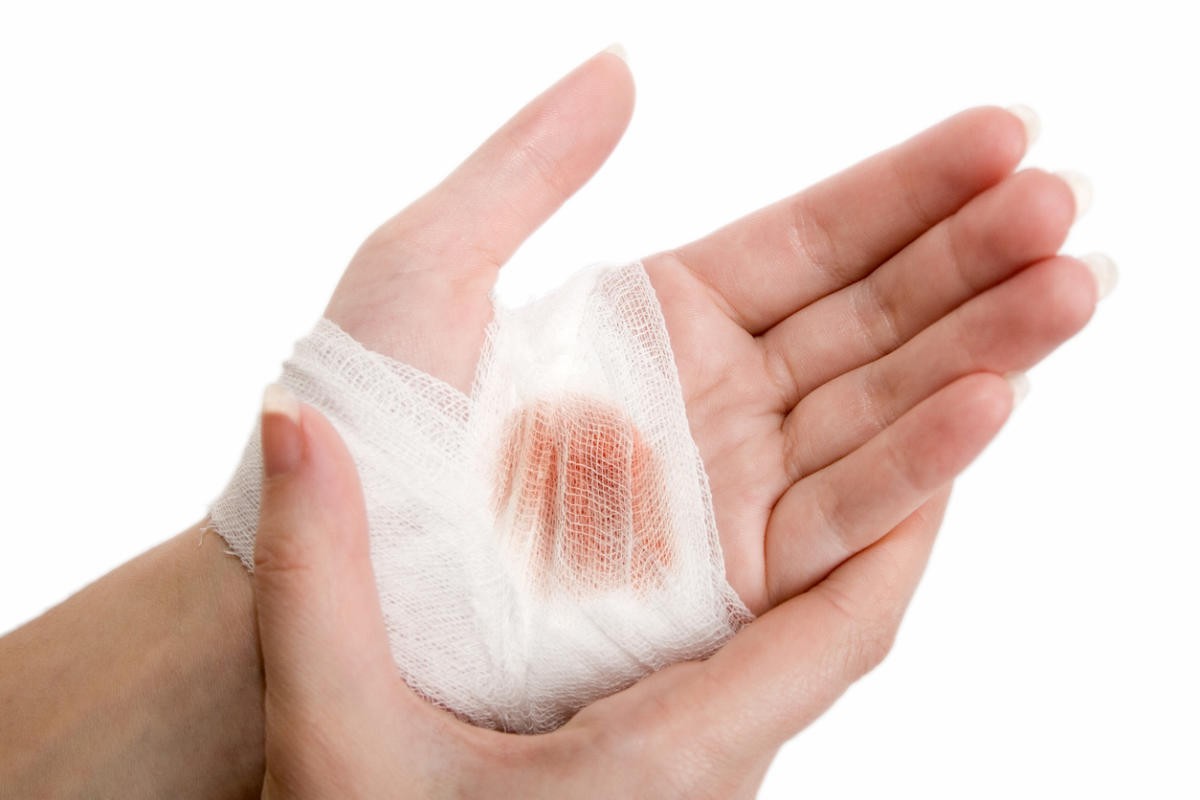 تعرف على تفسير حلم يد مجروحة لابن سيرين